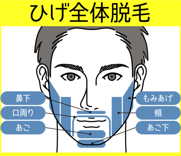 カレイドクリニックヒゲ全体脱毛範囲