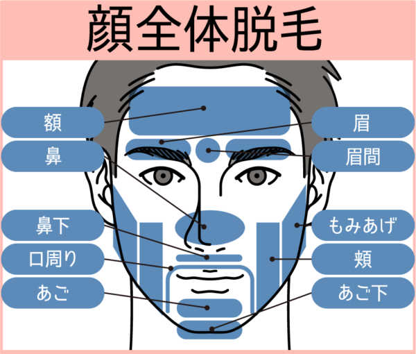 カレイドクリニック顔脱毛範囲