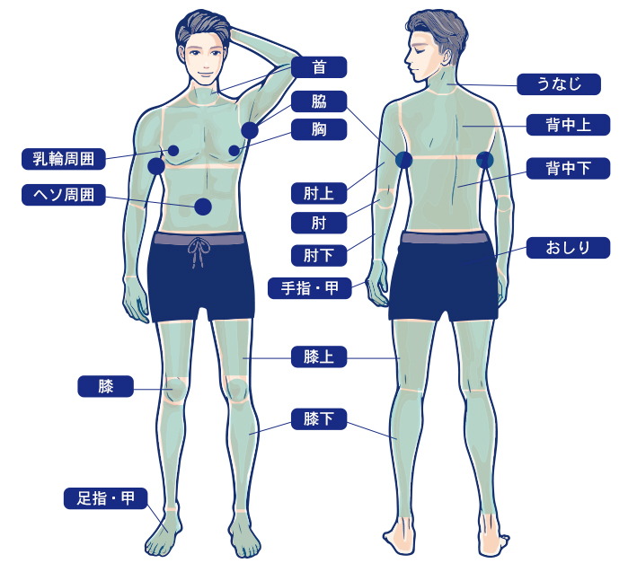 メンズトイトイトイクリニック全身脱毛範囲