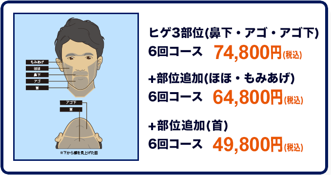 ゴリラクリニックヒゲ脱毛範囲