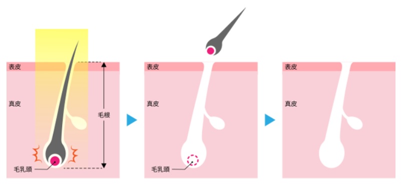 メンズエミナル施術方法